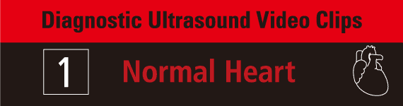 Diagnostic Ultrasound Video Clips 1- Normal Heart