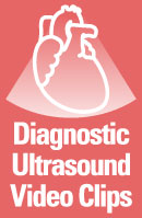 Diagnostic Ultrasound Video Clips