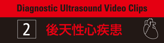 Diagnostic Ultrasound Video Clips 2- 後天性心疾患