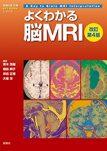 よくわかる脳MRI　改訂第4版