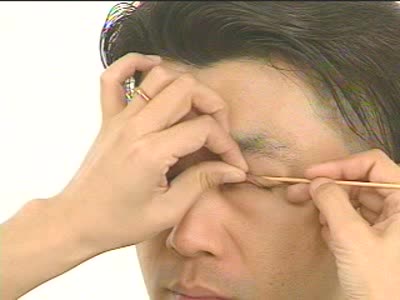 上眼瞼の眼瞼結膜の視診