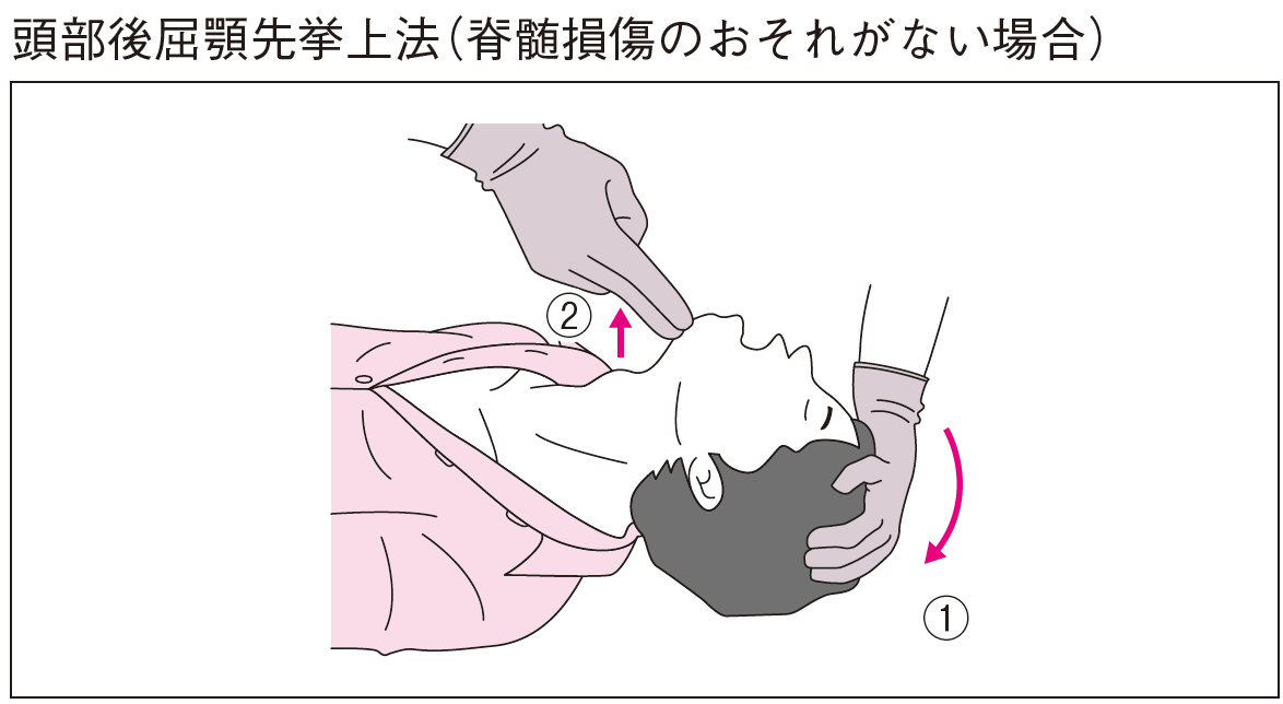 頭部後屈 正しい図