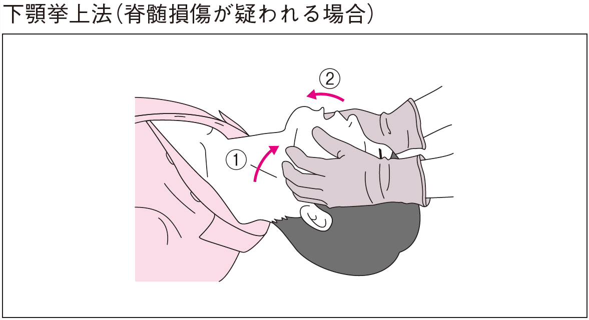 下顎挙上 正しい図