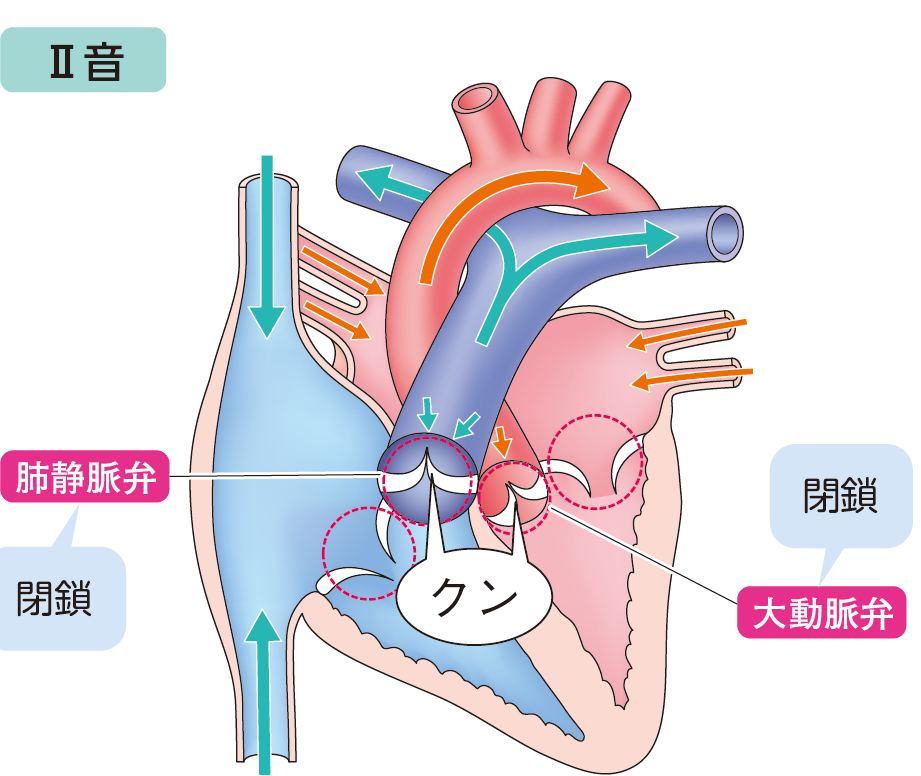 問題45誤りの図