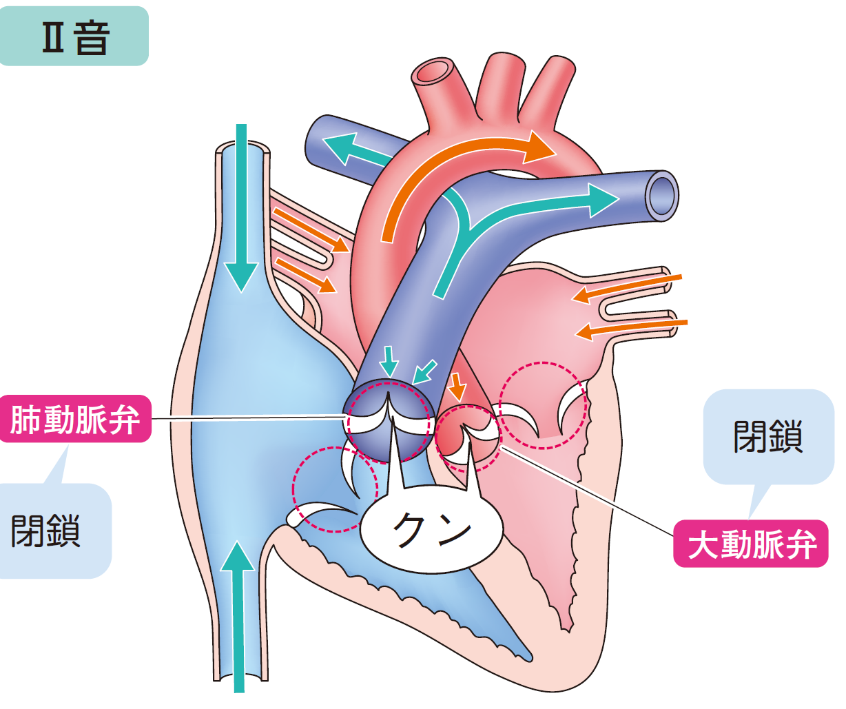 問題45正しい図