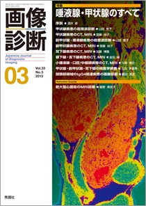 臨床画像 2013年 03月号 [雑誌] [雑誌] - 語学/参考書