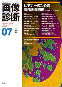 画像診断 Vol.34 No.8 2014年7月号 | Gakken メディカル出版事業部