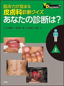 製品別でみる接触皮膚炎 | Gakken メディカル出版事業部