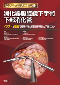 消化器腹腔鏡下手術 下部消化管 | Gakken メディカル出版事業部