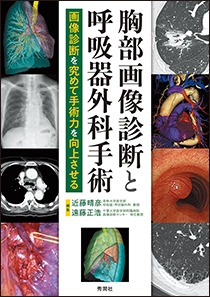 胸部画像診断と呼吸器外科手術 | Gakken メディカル出版事業部