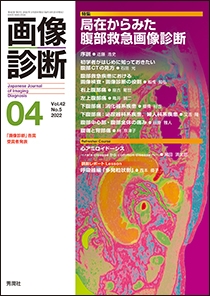 画像診断 Vol.42 No.5 2022年4月号 | Gakken メディカル出版事業部