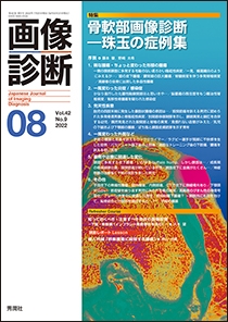 画像診断 Vol.42 No.9 2022年8月号 | Gakken メディカル出版事業部