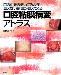 口腔粘膜病変アトラス | Gakken メディカル出版事業部