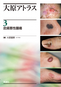大原アトラス3 皮膚悪性腫瘍 | Gakken メディカル出版事業部
