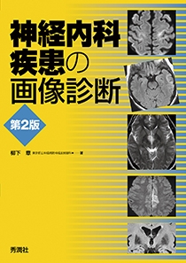 神経内科疾患の画像診断　第２版
