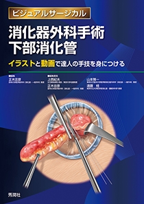 ブランド登録なし 消化器外科手術下部消化管 ビジュアルサージカル　イラストと動画で達人の手技を身につける／正木忠彦(編者),上西紀夫(編者),山本雅一(編者