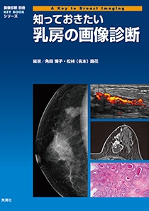 マンモグラフィのあすなろ教室 | Gakken メディカル出版事業部