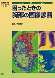 困ったときの胸部の画像診断 | Gakken メディカル出版事業部