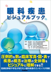 眼科疾患ビジュアルブック | Gakken メディカル出版事業部