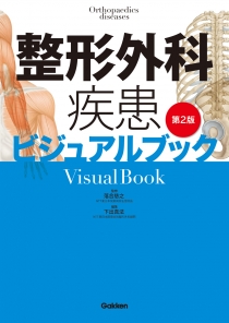 整形外科疾患ビジュアルブック　第2版
