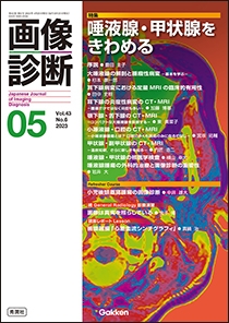 画像診断 Vol.43 No.6 2023年5月号 | Gakken メディカル出版事業部