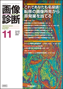 画像診断 Vol.43 No.13