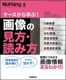 月刊ナーシング2021年4月増刊号Vol.41 No.5