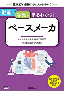 動画と写真でまるわかり! ペースメーカ